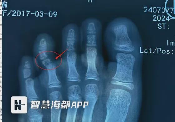 事发泉州欧乐堡景区！一酒店洗手台大理石掉落砸中7岁女童！(图3)